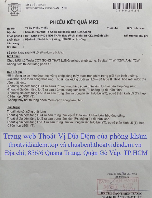 Thoát vị đĩa đệm bao lâu thì khỏi